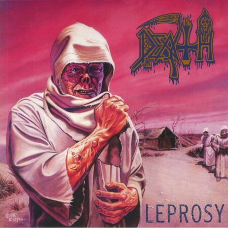 Leprosy