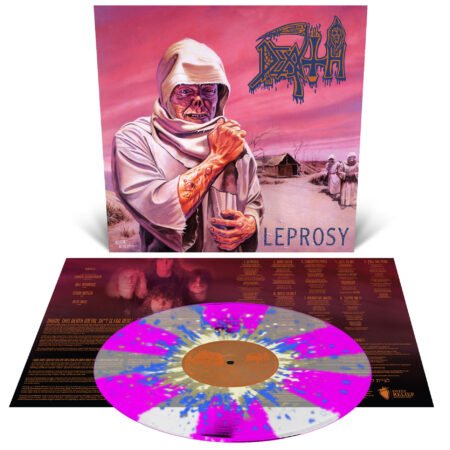 Leprosy - Image 3